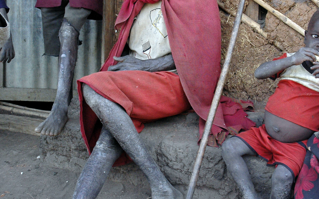 Ethiopia, 2005