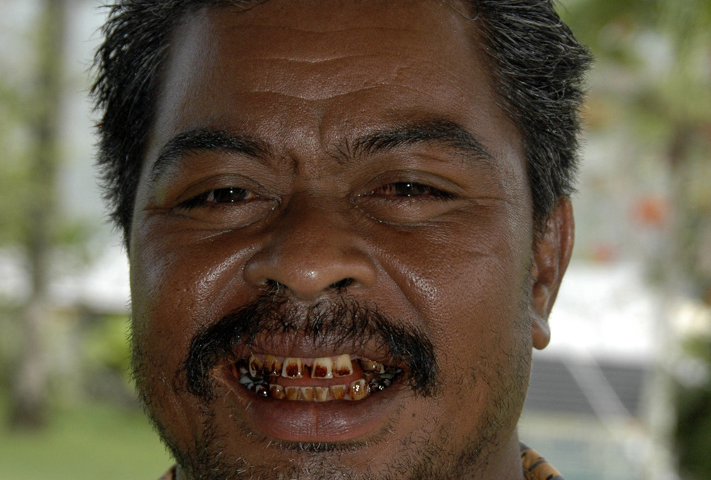 Federates States of Micronesia, 2008